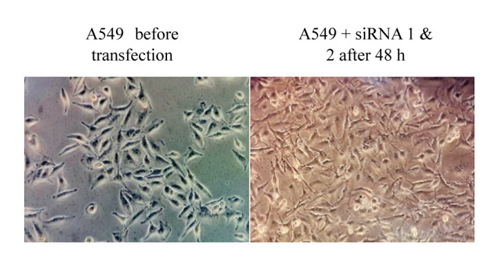 SOX2 Overlapping Transcript (<i>SOX2-OT</i>) Enhances the Lung Cancer Malignancy Through Interaction with <i>miR-194-5p/</i>SOX5 Axis.