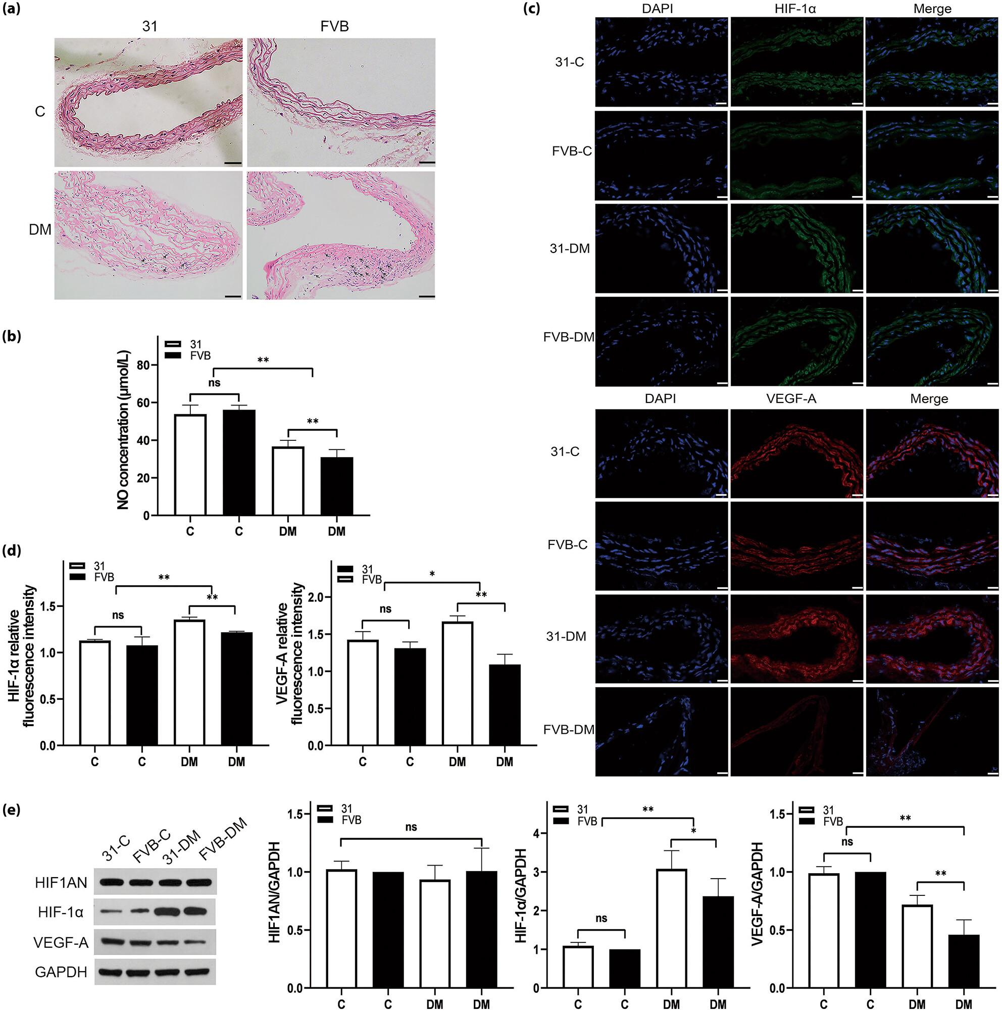 miR-31 ameliorates type 2 diabetic vascular damage through up-regulation of hypoxia-inducible factor-1α/vascular endothelial growth factor-A