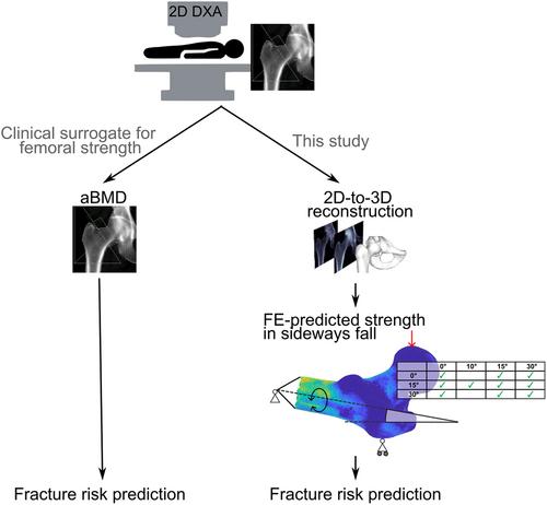 3D Finite Element Models Reconstructed From 2D Dual-Energy X-Ray Absorptiometry (DXA) Images Improve Hip Fracture Prediction Compared to Areal BMD in Osteoporotic Fractures in Men (MrOS) Sweden Cohort