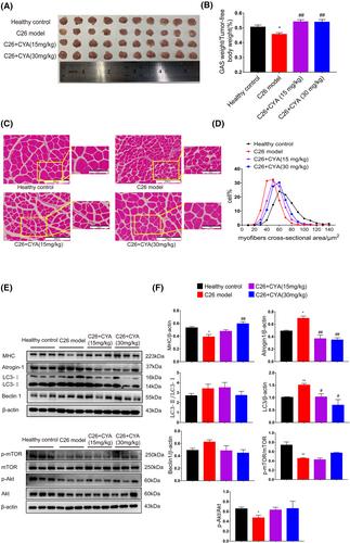 Corylifol A ameliorates muscle atrophy by inhibiting TAOK1/p38-MAPK/FoxO3 pathway in cancer cachexia