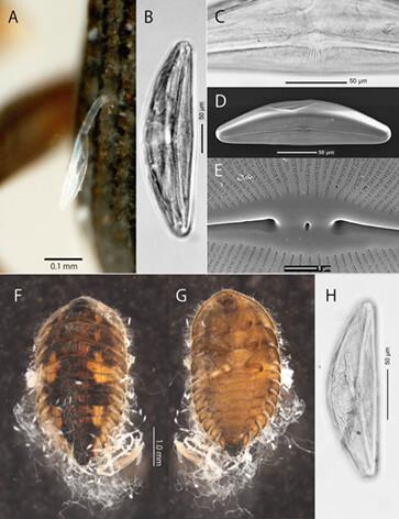 Invasive diatom, Cymbella janischii adhering on body surface of native aquatic beetles, Grouvellinus nitidus (Elmidae) and Ectopria opaca (Psephenidae) in Japan