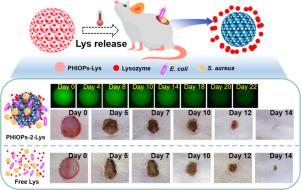 A sustained-release microcarrier effectively prolongs and enhances the antibacterial activity of lysozyme