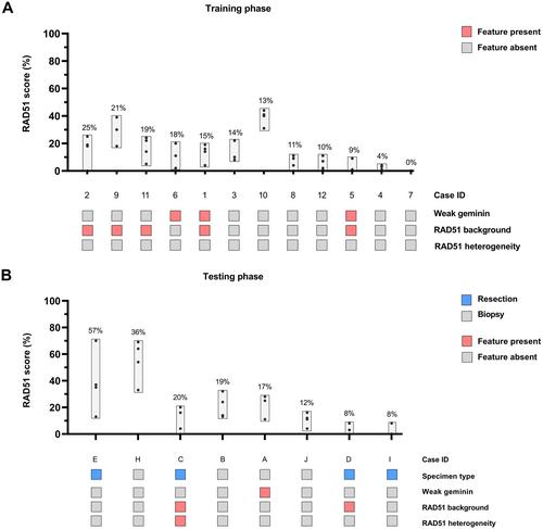 RAD51 as a biomarker for homologous recombination deficiency in high-grade serous ovarian carcinoma: robustness and interobserver variability of the RAD51 test