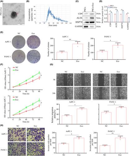 Pancreatic stellate cell-derived exosomal tRF-19-PNR8YPJZ promotes proliferation and mobility of pancreatic cancer through AXIN2