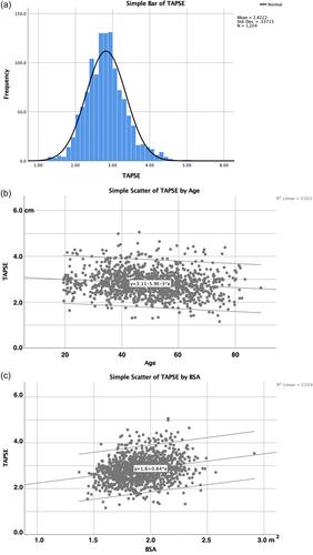 Regional motion of the AV-plane is related to the cardiac anatomy and deformation of the AV-plane. Data from the HUNT study