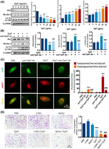 Treponema pallidum membrane protein Tp47 induced autophagy and inhibited cell migration in HMC3 cells via the PI3K/AKT/FOXO1 pathway