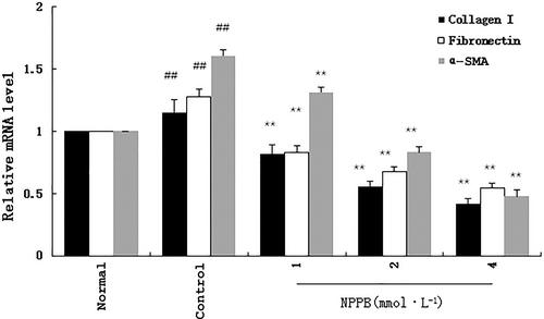 Role of the chloride channel blocker in the formation of filtering tract scars after glaucoma surgery in rats