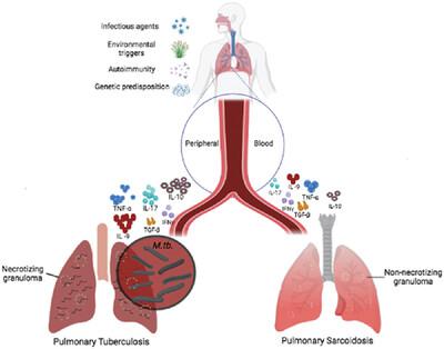 T-cell signature cytokines distinguish pulmonary sarcoidosis from pulmonary tuberculosis