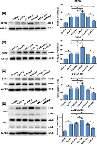 Effect of mesencephalic astrocyte-derived neurotrophic factor on the inflammatory response in human gingival fibroblasts cells