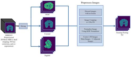 Toward more accurate diagnosis of multiple sclerosis: Automated lesion segmentation in brain magnetic resonance image using modified U-Net model