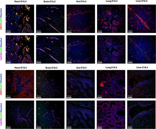 A temporally-restricted pattern of endothelial cell collagen 4 alpha 1 expression during embryonic development determined with a novel knockin Col4a1-P2A-eGFP mouse line