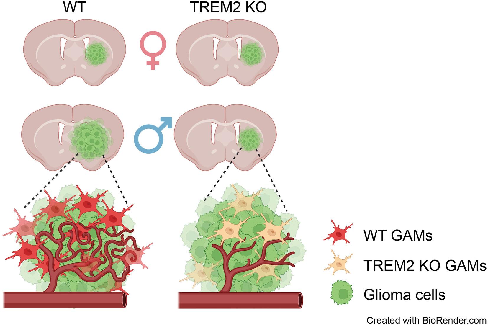 TREM2 promotes glioma progression and angiogenesis mediated by microglia/brain macrophages