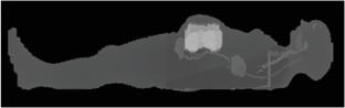 Fetal Organ Dose Assessment during Chest CT Examination Using Monte Carlo/Gate Simulation