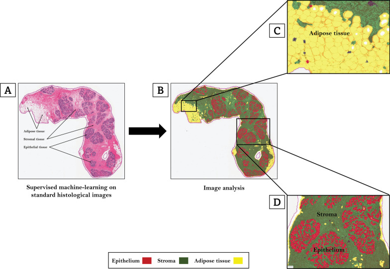 Host, reproductive, and lifestyle factors in relation to quantitative histologic metrics of the normal breast.