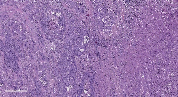 [Metastatic lesions of the adrenal glands. The experience of Endocrinology Research Center.]