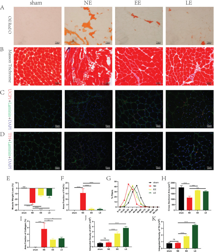 High-intensity interval training improves fatty infiltration in the rotator cuff through the β3 adrenergic receptor in mice.