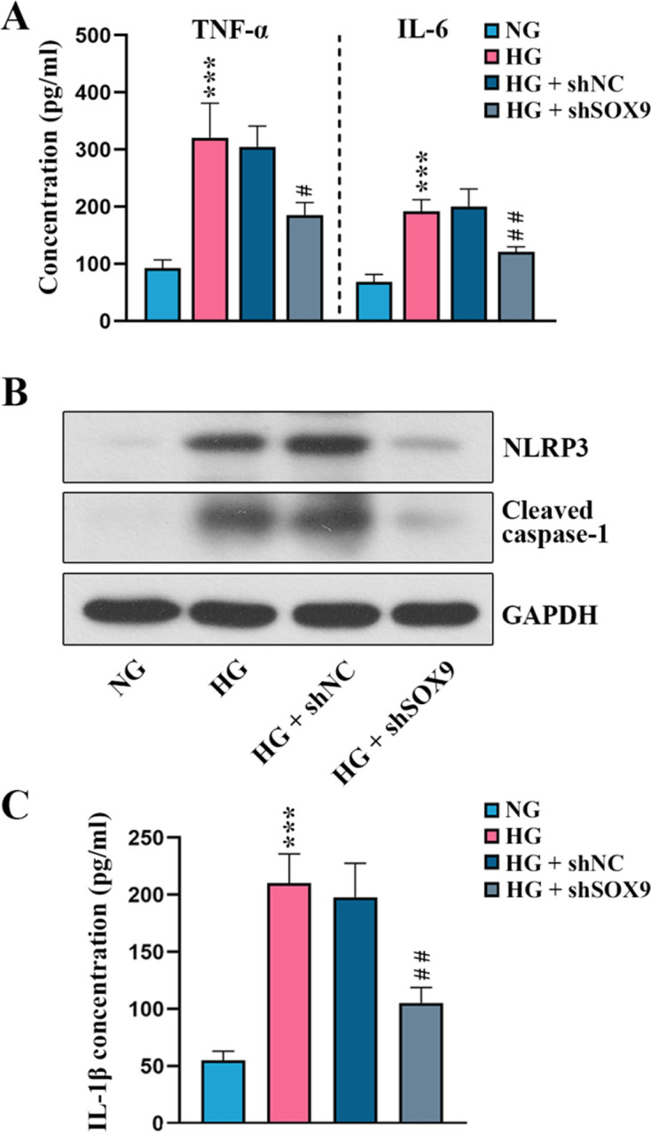 SRY-box transcription factor 9 modulates Müller cell gliosis in diabetic retinopathy by upregulating TXNIP transcription.