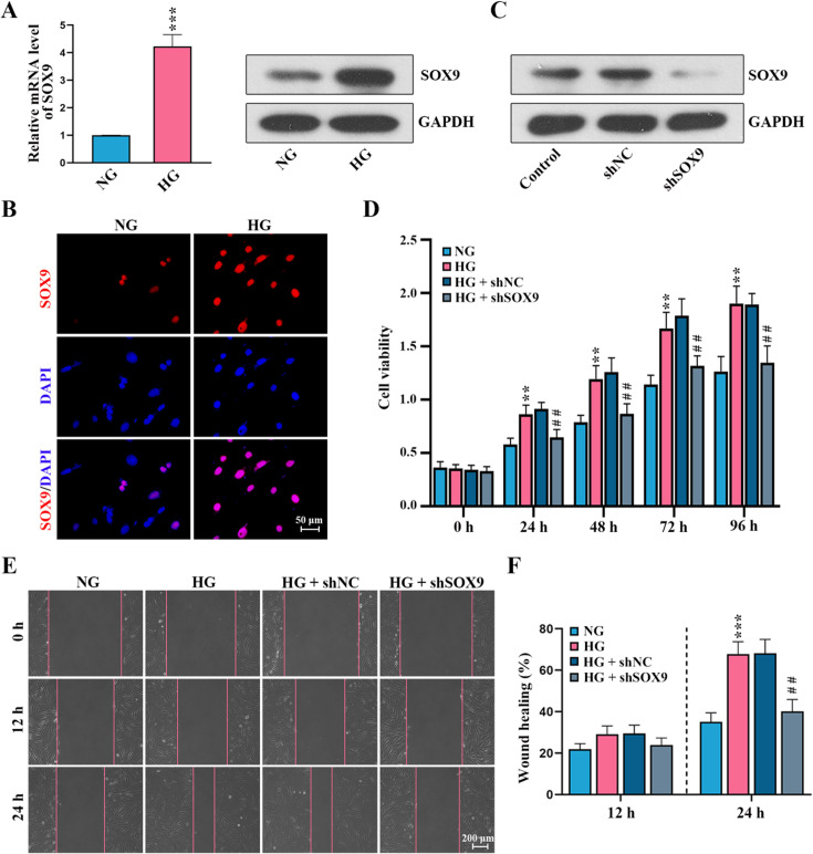 SRY-box transcription factor 9 modulates Müller cell gliosis in diabetic retinopathy by upregulating TXNIP transcription.