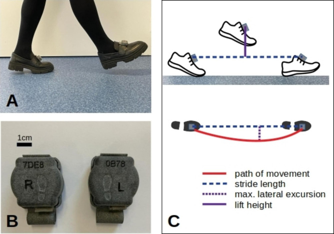 Subthalamic 85 Hz deep brain stimulation improves walking pace and stride length in Parkinson's disease patients.