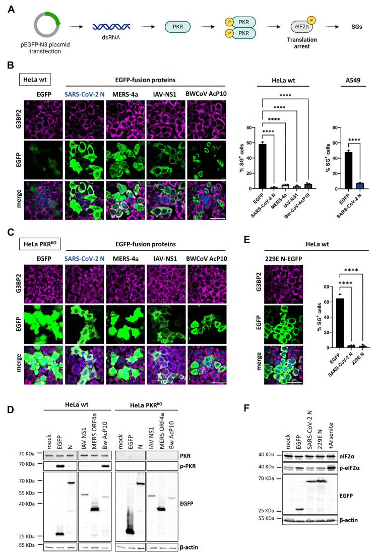 SARS-CoV-2 nucleocapsid protein inhibits the PKR-mediated integrated stress response through RNA-binding domain N2b.