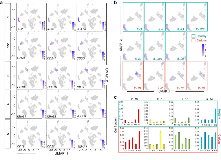 Extracellular matrix remodelling in dental pulp tissue of carious human teeth through the prism of single-cell RNA sequencing.