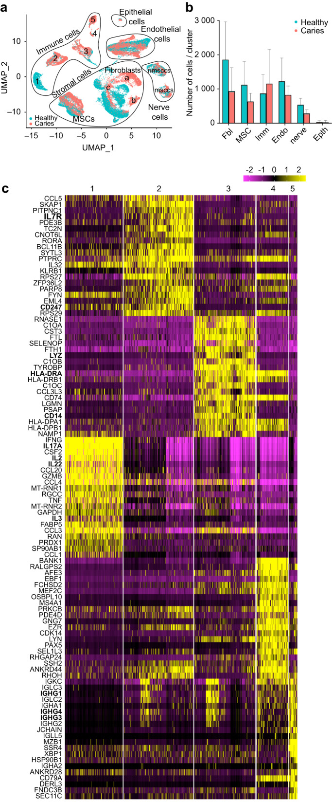 Extracellular matrix remodelling in dental pulp tissue of carious human teeth through the prism of single-cell RNA sequencing.