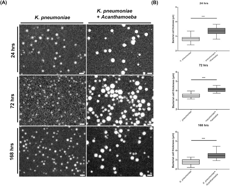 Enhancement of capsular hypermucoviscosity in Klebsiella pneumoniae by Acanthamoeba.