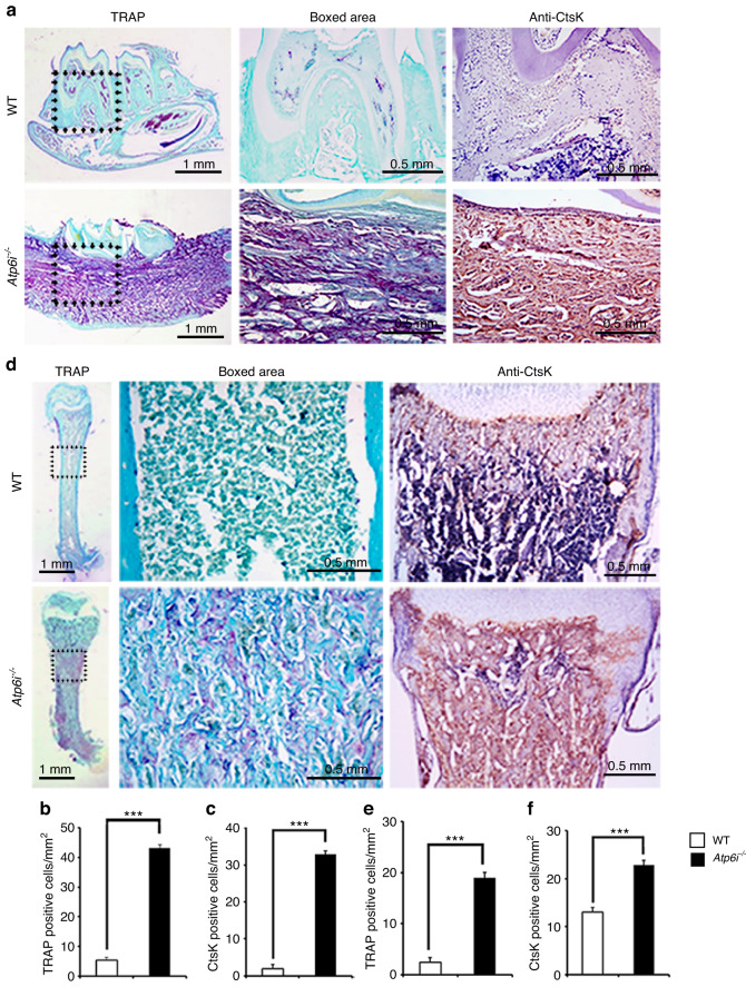 Atp6i deficient mouse model uncovers transforming growth factor-β1 /Smad2/3 as a key signaling pathway regulating odontoblast differentiation and tooth root formation.