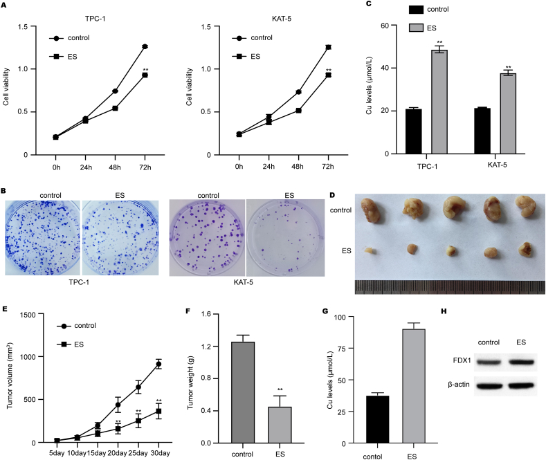 FDX1 inhibits thyroid cancer malignant progression by inducing cuprotosis.