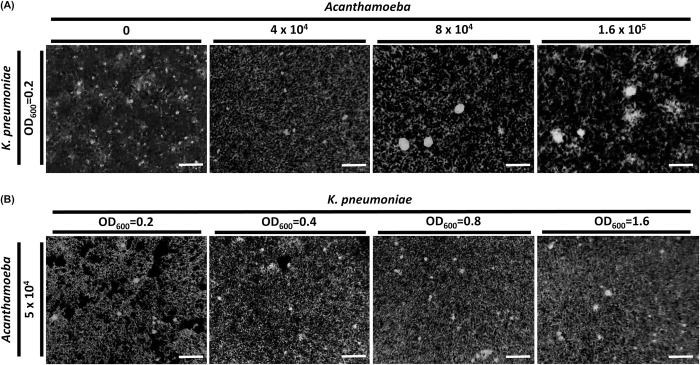 Enhancement of capsular hypermucoviscosity in Klebsiella pneumoniae by Acanthamoeba.