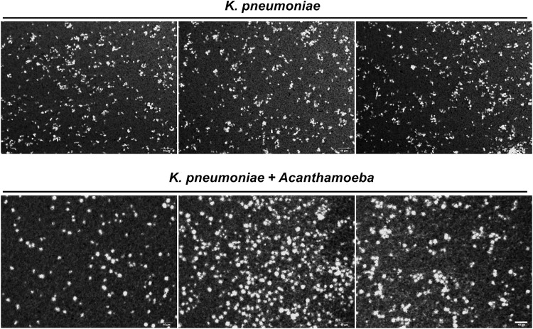 Enhancement of capsular hypermucoviscosity in Klebsiella pneumoniae by Acanthamoeba.