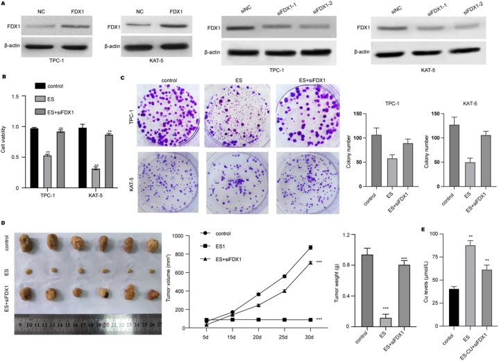 FDX1 inhibits thyroid cancer malignant progression by inducing cuprotosis.