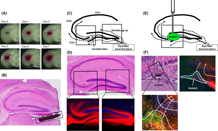 The past and present of therapeutic strategy for Alzheimer's diseases: potential for stem cell therapy.