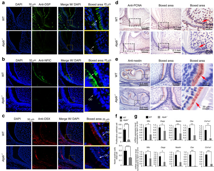 Atp6i deficient mouse model uncovers transforming growth factor-β1 /Smad2/3 as a key signaling pathway regulating odontoblast differentiation and tooth root formation.