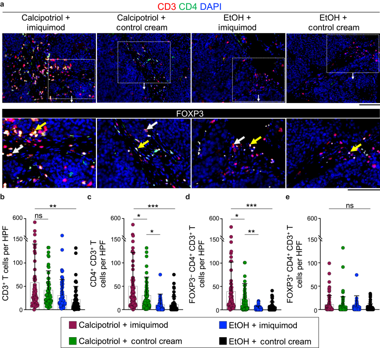 Topical Calcipotriol Plus Imiquimod Immunotherapy for Nonkeratinocyte Skin Cancers