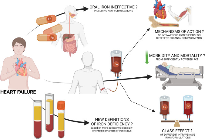 Pathophysiology and Treatment Opportunities of Iron Deficiency in Heart Failure: Is There a Need for Further Trials?