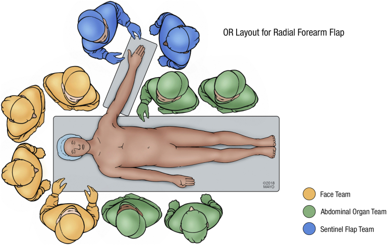 Maximizing Solid Organ and Face Transplant Procurement Team Coordination: The Posterior Tibial Artery Flap as an Ideal Sentinel Flap