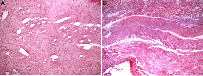 Puricelli biconvex arthroplasty: an experimental study in sheep.