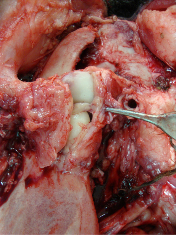 Puricelli biconvex arthroplasty: an experimental study in sheep.