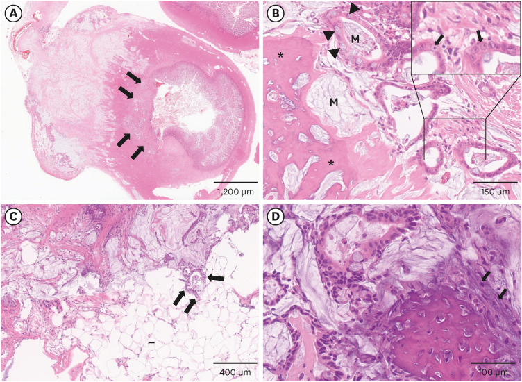 Metastatic intestinal adenocarcinoma with osseous metaplasia in two Domestic Korean Shorthair cats.