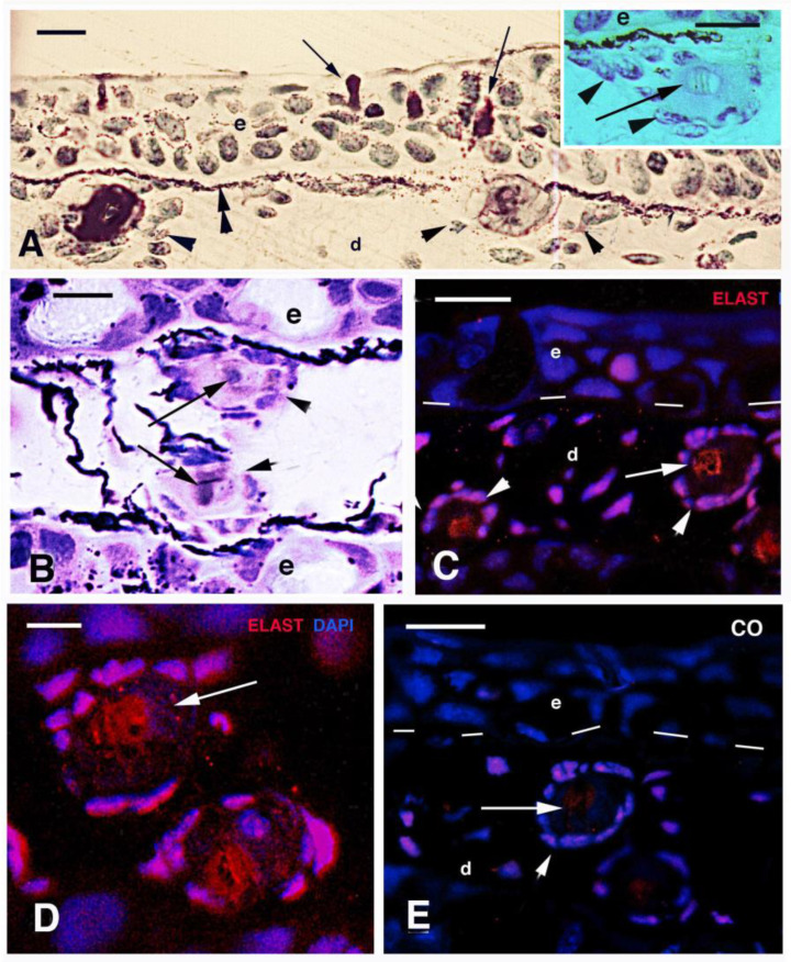 Immunolocalization of Some Epidermal Proteins and Glycoproteins in the Growing Skin of the Australian Lungfish (<i>Neoceratodus forsteri</i>).