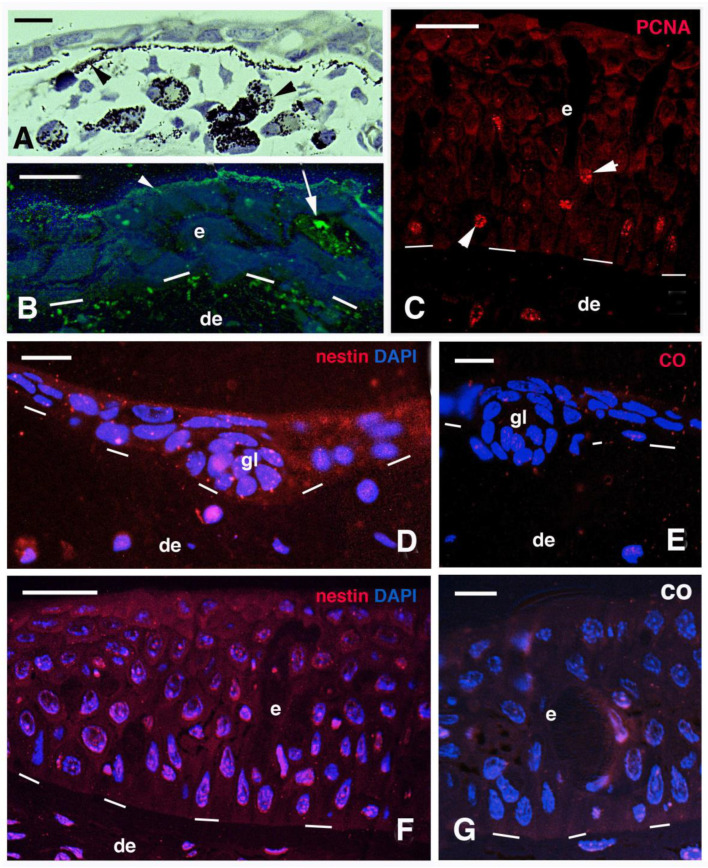 Immunolocalization of Some Epidermal Proteins and Glycoproteins in the Growing Skin of the Australian Lungfish (<i>Neoceratodus forsteri</i>).