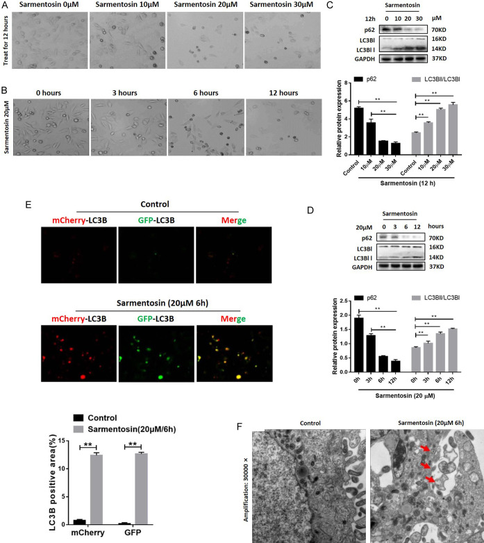 Sarmentosin Induces Autophagy-dependent Apoptosis via Activation of Nrf2 in Hepatocellular Carcinoma.