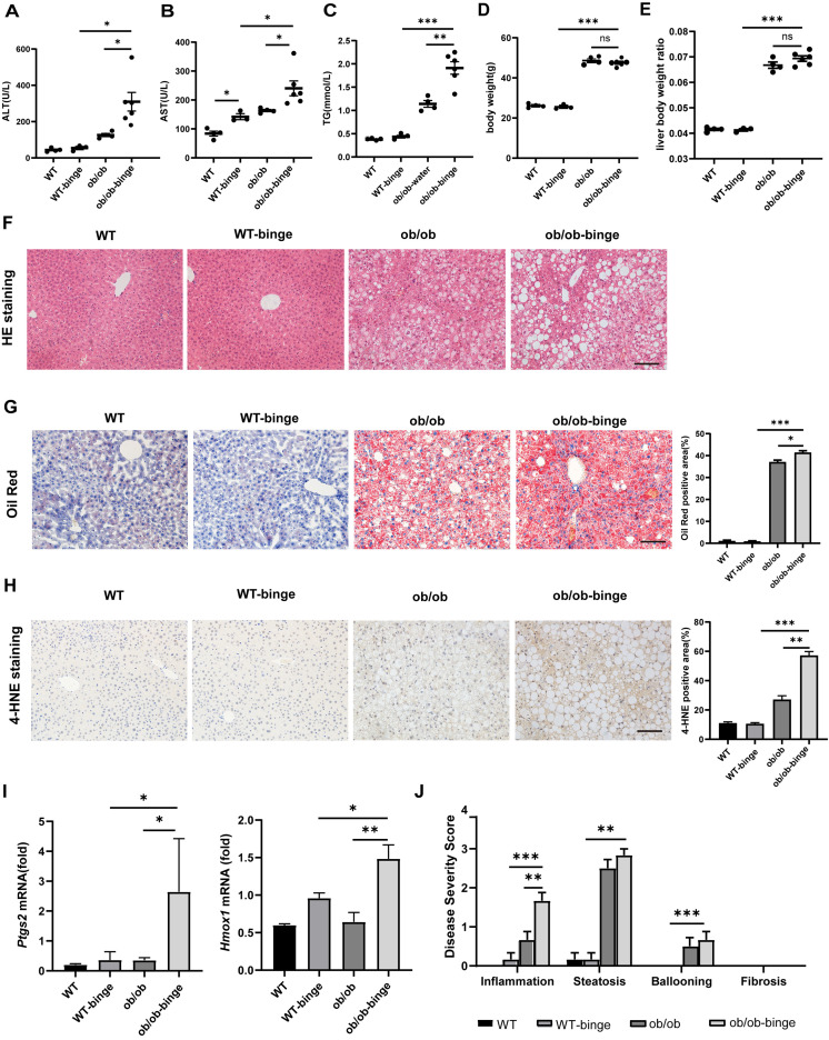 New murine model of alcoholic hepatitis in obesity-induced metabolic-associated fatty liver disease.