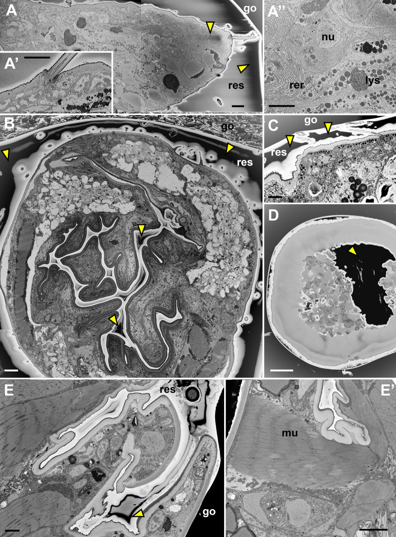 Minimal resin embedding of SBF-SEM samples reduces charging and facilitates finding a surface-linked region of interest.