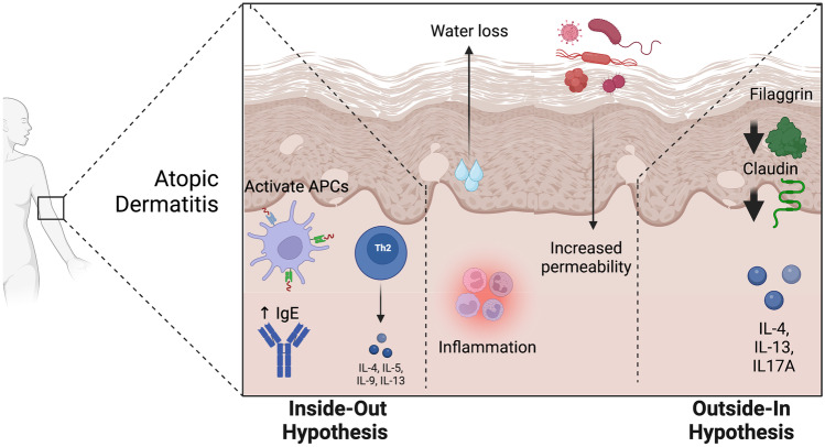 The Impact of Air Pollution on Atopic Dermatitis.