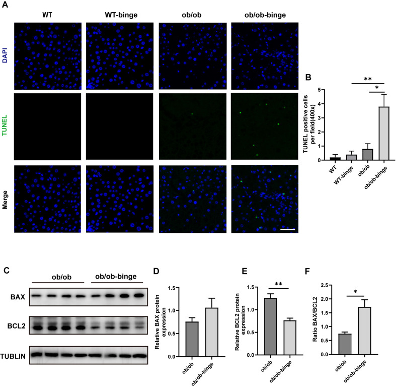 New murine model of alcoholic hepatitis in obesity-induced metabolic-associated fatty liver disease.