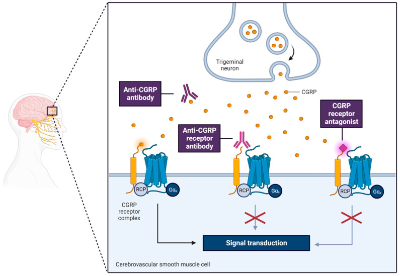 Migraine: Advances in the Pathogenesis and Treatment.