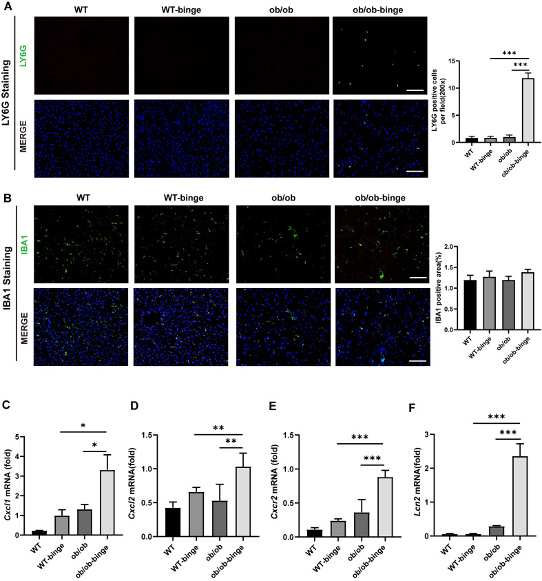 New murine model of alcoholic hepatitis in obesity-induced metabolic-associated fatty liver disease.