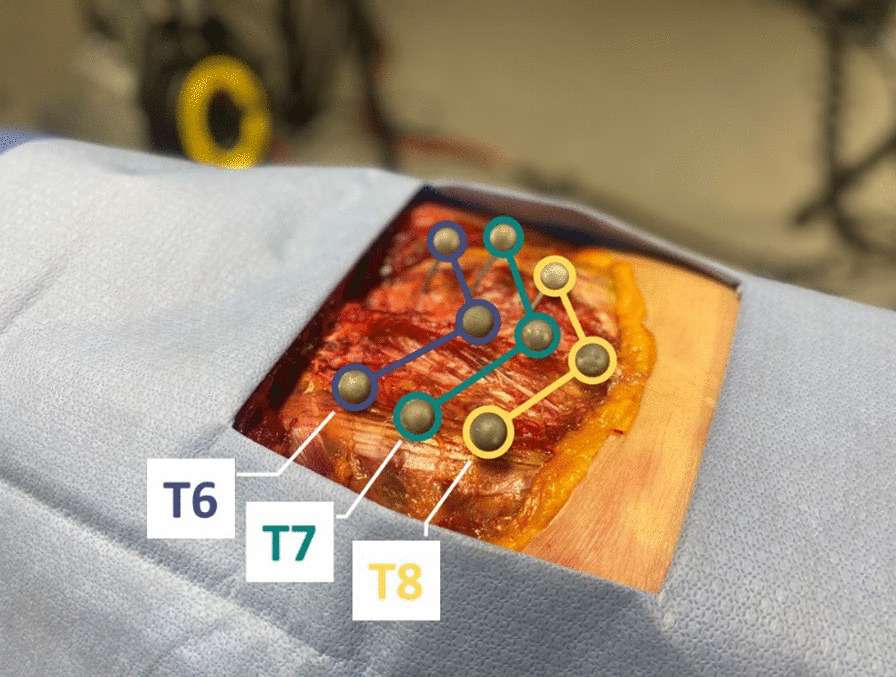 Investigation of the factors influencing spinal manipulative therapy force transmission through the thorax: a cadaveric study.